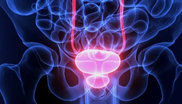 Cresce número de cirurgias robóticas de câncer de próstata pós pandemia