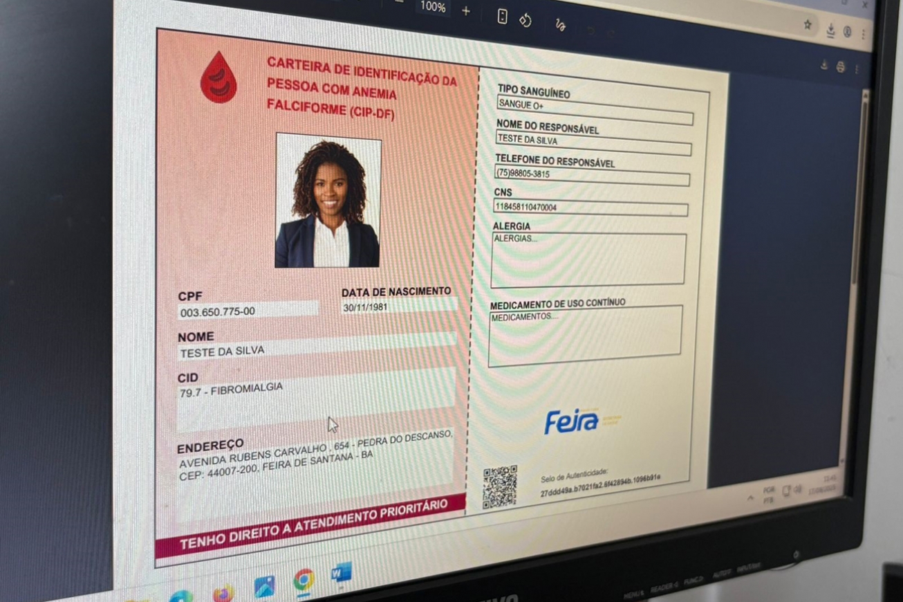 Feira de Santana passa a emitir carteirinha para pessoas com anemia falciforme