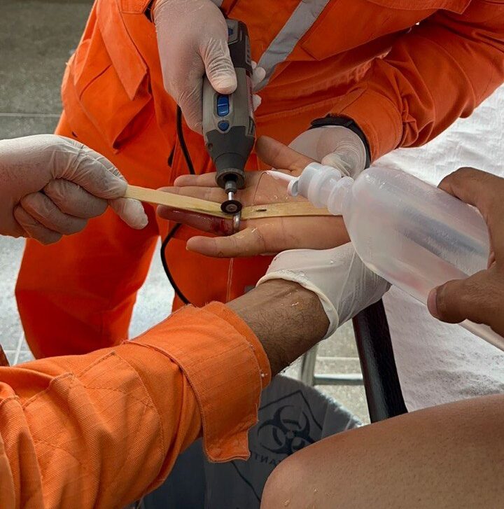 Homem fica com anel preso ao dedo e precisa de ajuda dos bombeiros para retirar acessório
