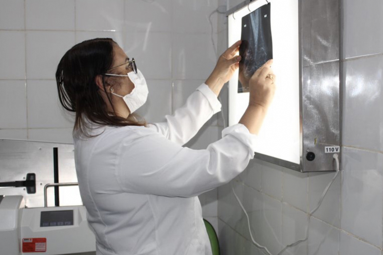 Fundação Hospitalar estima superar, em 2026, número de mamografias realizadas no ano passado