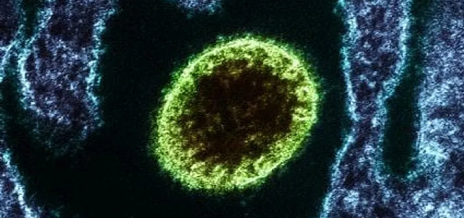 “Brasil não tem caso de Nipah confirmado” diz Ministério da Saúde sobre fake news