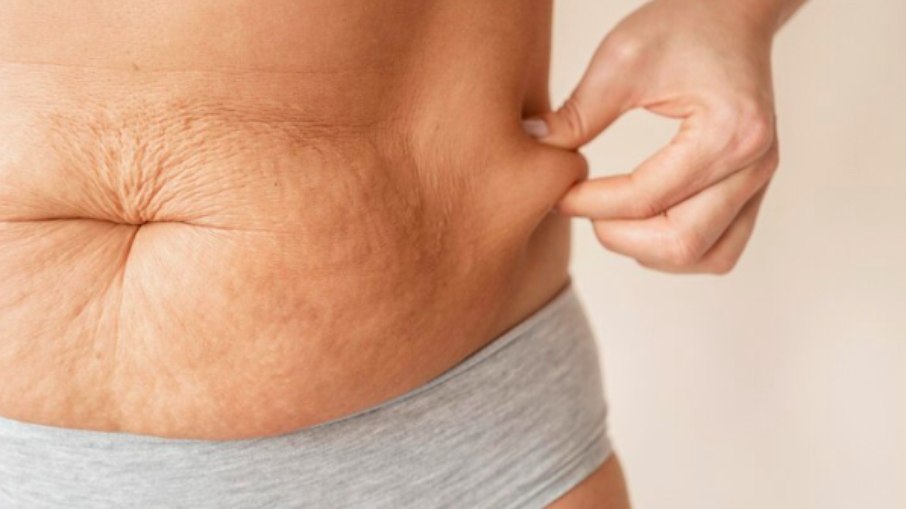 Novas técnicas ajudam a combater flacidez e reforçam autoestima, defendem especialistas